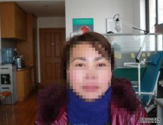 <b>裝仿真義眼，效果和真眼差不多嗎</b>
